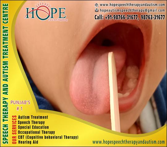 Speech Therapy Centre Ludhiana, speech therapist in ludhiana, speech language therapy training in ludhiana, voice therapy Centre Ludhiana, Speech Therapy Centre for Kids in Ludhiana, Speech Therapy Institute in Ludhiana, Speech Therapy Doctors in Ludhiana, Speech Therapy Centre in Punjab, stammering Aid Centre, misauticulation-tutlana Centre in Ludhiana Punjab, Speech Therapy Centre for Children in Ludhiana Punjab, https://www.hopespeechtherapyandautism.com +91-98766-31677, +91-98763-31677